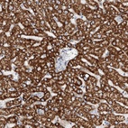 Anti-TAS2R60 Antibody