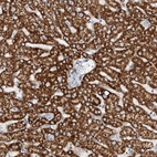 Anti-TAS2R60 Antibody
