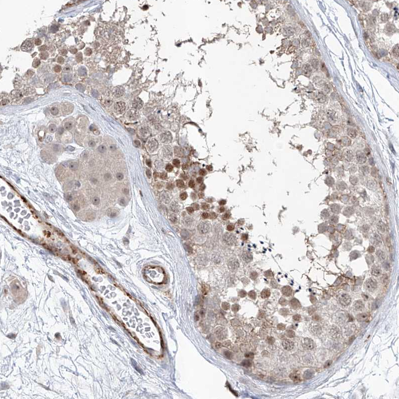 Anti-ZBTB48 Antibody