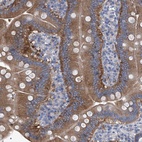 Anti-XPNPEP1 Antibody