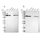 Western blot analysis using Anti-XPNPEP1 antibody HPA030419 (A) shows similar pattern to independent antibody HPA030420 (B).