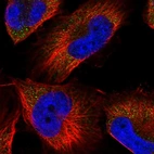 Immunofluorescent staining of human cell line U-251 MG shows localization to cytosol.