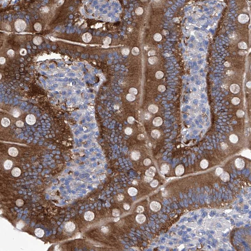 Anti-XPNPEP1 Antibody