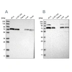 Western blot analysis using Anti-XPNPEP1 antibody HPA030420 (A) shows similar pattern to independent antibody HPA030419 (B).