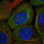 Immunofluorescent staining of human cell line A-431 shows localization to cytosol.