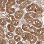 Immunohistochemical staining of human kidney shows strong cytoplasmic positivity in cells in tubules.