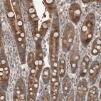 Immunohistochemical staining of human duodenum shows moderate cytoplasmic positivity in glandular cells.