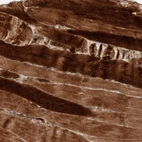 Immunohistochemical staining of human skeletal muscle shows strong cytoplasmic positivity in myocytes.