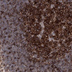 Anti-FAM167A Antibody