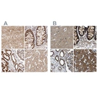 Anti-NDUFV3 Antibody