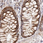 Immunohistochemical staining of human colon using Anti-NDUFV3 antibody HPA030427.