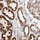 Immunohistochemical staining of human kidney using Anti-NDUFV3 antibody HPA030427.