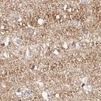 Immunohistochemical staining of human cerebral cortex using Anti-NDUFV3 antibody HPA030427.