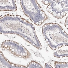 Immunohistochemical staining of human upper gastrointestinal shows moderate to strong granular cytoplasmic positivity in glandular cells.