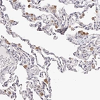 Immunohistochemical staining of human lung shows moderate to strong granular cytoplasmic positivity in macrophages.