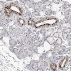 Immunohistochemical staining of human salivary gland shows moderate to strong granular cytoplasmic positivity in ductal cells.