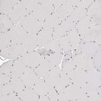 Immunohistochemical staining of human skeletal muscle shows no positivity in myocytes as expected.