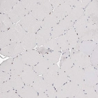 Immunohistochemical staining of human skeletal muscle shows no positivity in myocytes as expected.