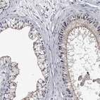 Immunohistochemical staining of human epididymis shows moderate positivity in apical membrane in glandular cells.