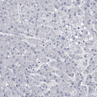 Anti-PRSS8 Antibody