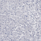 Immunohistochemical staining of human liver shows no positivity in hepatocytes as expected.
