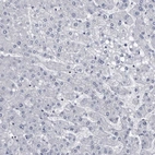 Immunohistochemical staining of human liver shows no positivity in hepatocytes as expected.