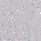 Immunohistochemical staining of human cerebral cortex shows no positivity in neuronal cells as expected.