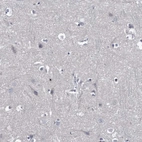 Immunohistochemical staining of human cerebral cortex shows no positivity in neuronal cells as expected.