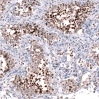 Anti-MICAL2 Antibody