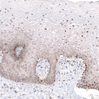 Immunohistochemical staining of human cervix shows moderate nuclear positivity in squamous epithelial cells.