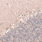 Immunohistochemical staining of human cerebellum shows moderate nuclear positivity in glial cells.