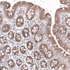 Immunohistochemical staining of human colon shows moderate cytoplasmic positivity in glandular cells.