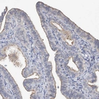 Immunohistochemical staining of human fallopian tube shows weak to moderate positivity in luminal membrane in glandular cells.