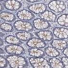 Immunohistochemical staining of human colon shows weak to moderate positivity in luminal membrane in glandular cells.