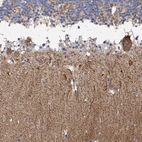 Immunohistochemical staining of human cerebellum shows moderate positivity in neuropil.