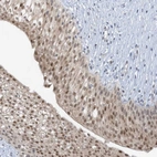 Anti-UBE2E1 Antibody