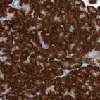 Anti-RPL26 Antibody
