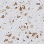 Immunohistochemical staining of human cerebral cortex shows strong cytoplasmic positivity in neurons.