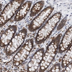 Immunohistochemical staining of human rectum shows strong cytoplasmic positivity in glandular cells.