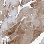 Immunohistochemical staining of human skeletal muscle shows moderate cytoplasmic positivity in myocytes.