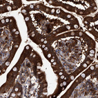 Immunohistochemical staining of human small intestine shows strong membranous and cytoplasmic positivity in glandular cells.
