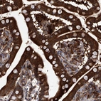 Immunohistochemical staining of human small intestine shows strong membranous and cytoplasmic positivity in glandular cells.