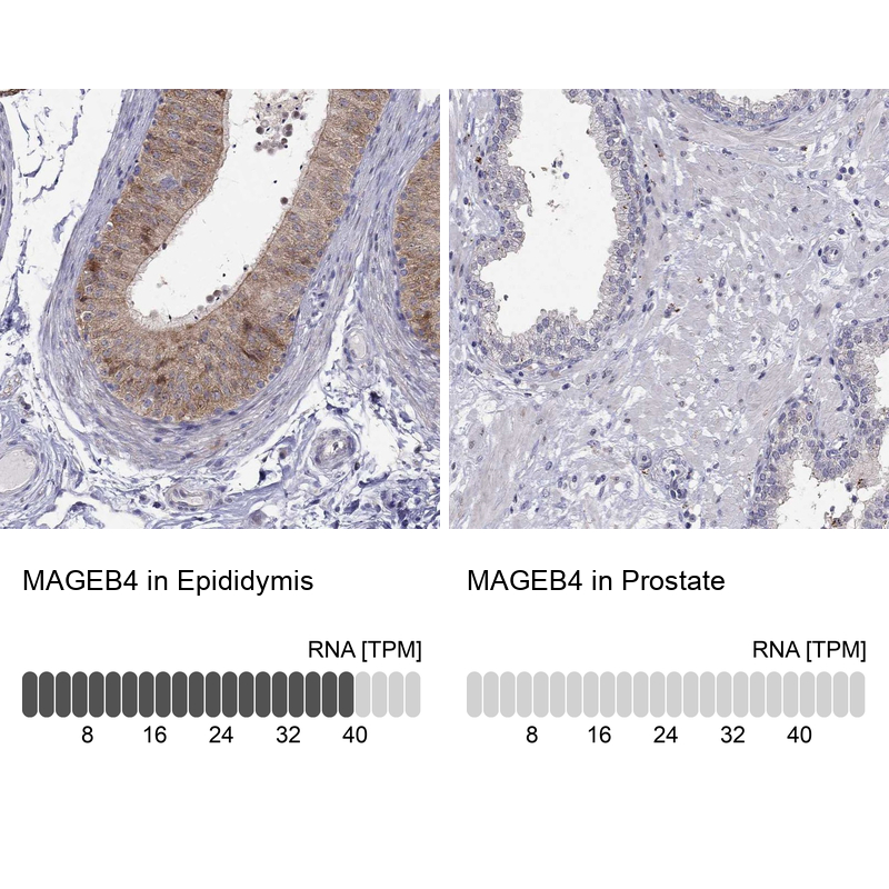 Anti-MAGEB4 Antibody