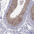 Immunohistochemical staining of human epididymis shows high expression.