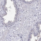 Immunohistochemical staining of human prostate shows low expression as expected.
