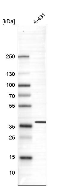 Anti-SUSD6 Antibody