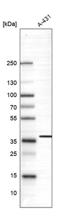 Anti-SUSD6 Antibody