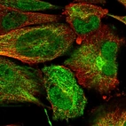 Immunofluorescent staining of human cell line U-251 MG shows localization to nucleoplasm & intermediate filaments.