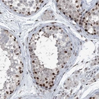 Anti-BMI1 Antibody