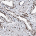 Immunohistochemical staining of human prostate shows moderate nuclear positivity in glandular cells.